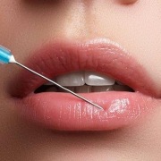 SOFIDERM DERM  SUB SKIN, kwas usieciowany,medyczn