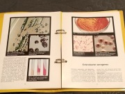 Mocz pod mikroskopem - książka - uryna żywa kropla krwi bio rezonans krew