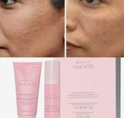 Zestaw do Mikrodermabrazji TimeWise Mary Kay