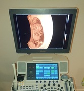 Aparat USG Mindray DC8 4 glowice, 3-4D klasa kliniczna