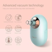 Mosen Mini Urządzenie odkurzacz do usuwania zaskórników wągrów 421