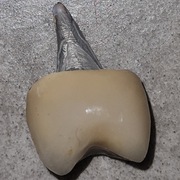 Korona ceramiczna PG5