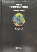 Atlas termograficzny : rak piersi