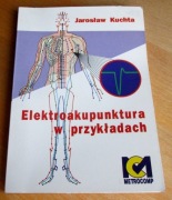 Jarosław Kuchta - ELEKTROAKUPUNKTURA W PRZYKŁADACH