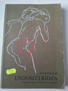 ANTONI PALATYŃSKI ENDOMETRIOZA