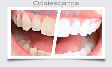 OPALESCENCE PF 2* ГЕЛЬ ДЛЯ БЕЛЕНИЯ ЗУБОВ 16%__США