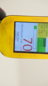 фото thumb №7, Крила правий перед toyota auris i 06-09r 202