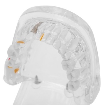 MODEL ZĘBÓW DENTYSTYCZNYCH DLA DOROSŁYCH