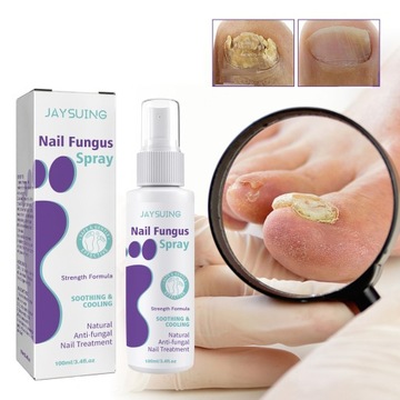 JAYSUING Nail Fungus 100 мл осветляющий спрей от грибка ногтей