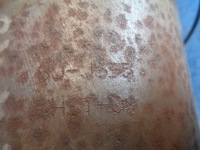 фото thumb №9, Колектор випускний каталізатор 50511164 51804371 alfa romeo mito 1.4 16v