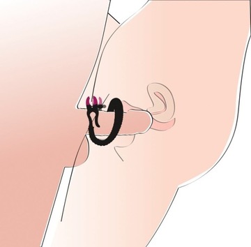 ИНТИМНЫЙ РАСПРЕДЕЛИТЕЛЬ STRONG Расширитель половых губ