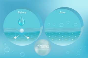KWAS HIALURONOWY 5% 30ml TRÓJAKTYWNY serum