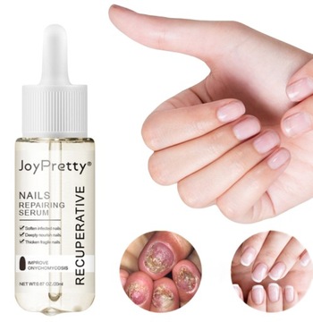 Грибок ногтей Strong Nail Repair Liquid