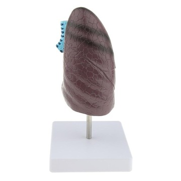 Изменения в легких органов дыхания 2:3 Lifesize M