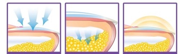 JAYSUING Nail Fungus 100 мл осветляющий спрей от грибка ногтей