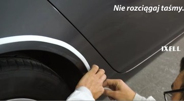 IXELL Маскирующая пена для кариеса 13 мм 10 м 1531