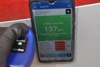 фото thumb №11, Капот кришка двигуна z176 opel corsa e 14-20