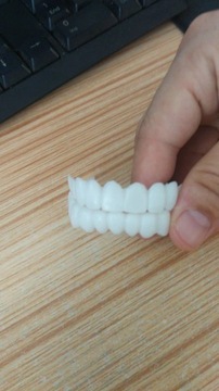 Новейшая привязка к Smile Dental, верхние нижние накладные зубы