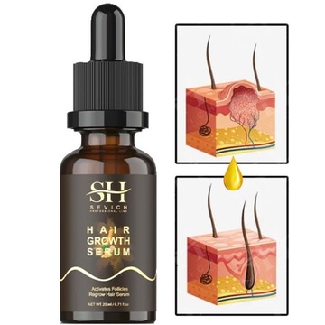 Sevich Hair Growth Essence Масло для роста