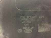 фото thumb №6, Hyundai tucson iv захист двигуна