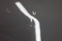 фото thumb №11, Hyunday ix35 дверь правый перед d1702 9h