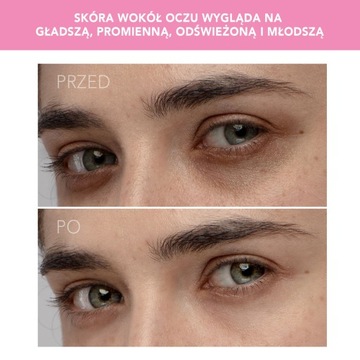 Массажер для контура глаз Foreo IRIS
