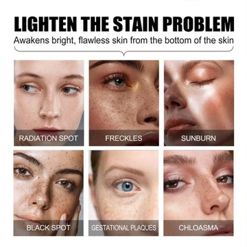 Сыворотка для лица Fading Essence Fade Black Spots Укрепляющая кожу