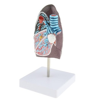Изменения в легких органов дыхания 2:3 Lifesize M