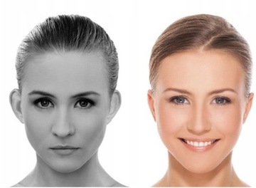 Otostick эстетические корректоры оттопыренных ушей + БЕСПЛАТНО