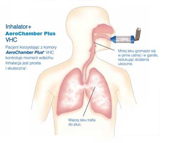 AeroChamber Plus Flow-Vu взрослые, дети фиолетовые