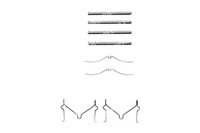 фото thumb №1, Delphi набор монтажный тормозных колодок mazda 121 ii 323 c