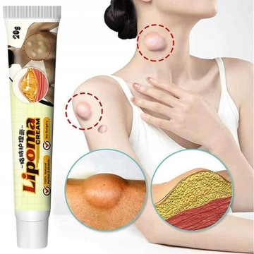 Yfp Lipoma Cream трав'яні натуральні жирові грудочки