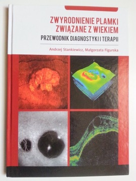 Zwyrodnienie plamki związane z wiekiem