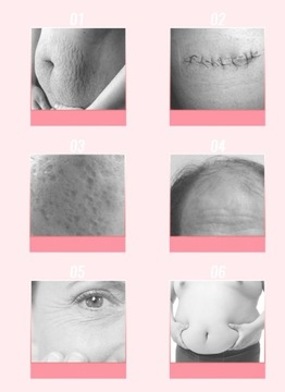 3x Derma Roller BODY FACE EYES TITANIUM Dermaroller
