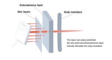Aparat do laseroterapii Hcure zimny laser PROMOCJA