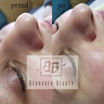 H2 PEEL WYDGODE CHOEADING+ Presence Promotion