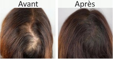 Ecobell Krem Do Zagęszczania Wypadanie Włosów