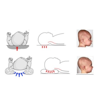 ХОРОШАЯ ОРТОПЕДИЧЕСКАЯ ПОДУШКА ДЛЯ ГОЛОВЫ ДЛЯ ДЕТЕЙ
