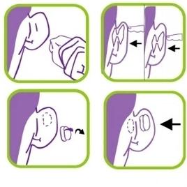 Oto.stick Эстетические корректоры для выступающих ушей