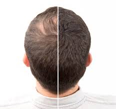 REHAIR косметика - Утолщение волос, микроволокна