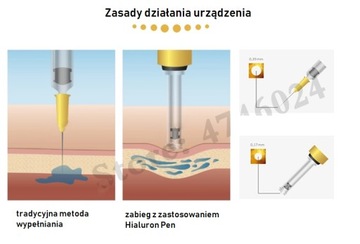 Безыгольное увеличение губ филлером HIALURON PEN