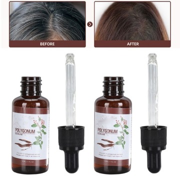 2 шт. 30 мл. Сыворотка для волос He Shou Wu Масло для ухода за волосами 69