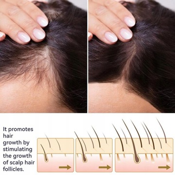 Спрей для роста волос, которые быстро растут против выпадения