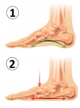 СТЕЛКИ ДЛЯ ОРТОПЕДИЧЕСКОЙ ОБУВИ VAYA ПРИ ПЛОСКОСТОПИИ