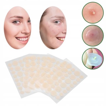 ПАТЧИ ОТ АКНЕ ОТ Прыщей 144 ШТ.