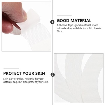 ИЗДЕЛИЯ ДЛЯ СЛИЗКОЙ СТОМЫ ДАВЛЕНИЯ КОЛЬЦА