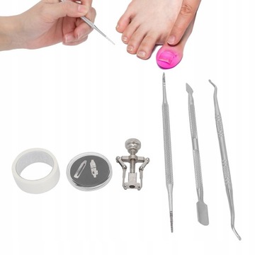 КОРРЕКЦИЯ ВРАСТНЫХ НОГТЕЙ НОСИНЫЕ