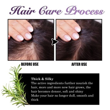 3 шт., 30 мл спрей для роста волос с экстрактами