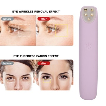 Электрический массажер для глаз RF EMS Vibration