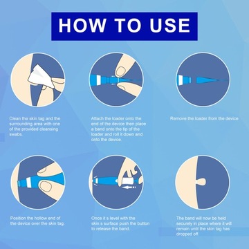 2 в 1 набор для автоматического удаления меток с кожи Micro Skin Tag